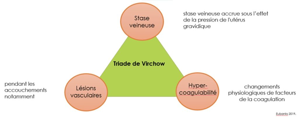 triadedeVirchow Le Smartleg® d’INNOTHERA Collant de compression